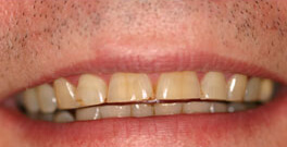 P C closeup before dental treatment actual patient