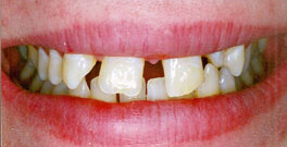 K D closeup before dental treatment actual patient