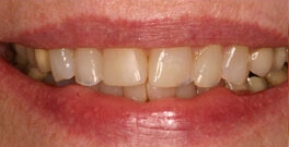 J G closeup before dental treatment actual patient