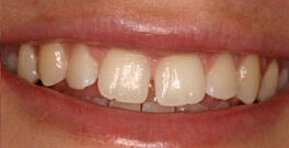 L H closeup before dental treatment actual patient
