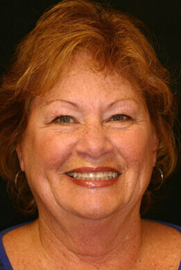 Smiling dental patient before dental treatment