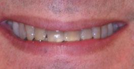 J H closeup before dental treatment actual patient