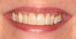 C T closeup after dental treatment actual patient