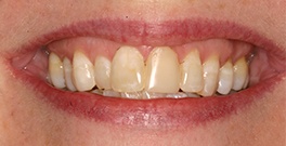 C T closeup before dental treatment actual patient