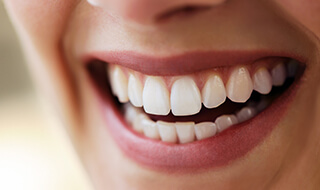 Closeup of beautiful smile after dental bonding