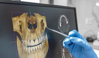Close-up of dental scan displayed on computer monitor