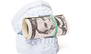 Roll of money tucked between teeth of dental model