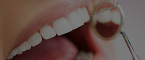Closeup of smile during preventive dentistry examination