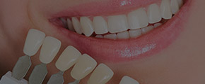 Woman's smile compared to cosmetic dentistry restoration color options