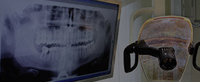 dental x-ray image on screen