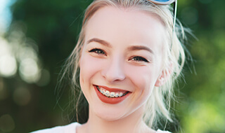 Woman with Six Month Smiles braces smiling