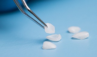 Veneers being held in tweezers