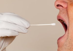 man mouth open for cotton swab