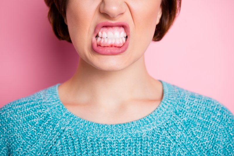 A woman showing off her sensitive gums